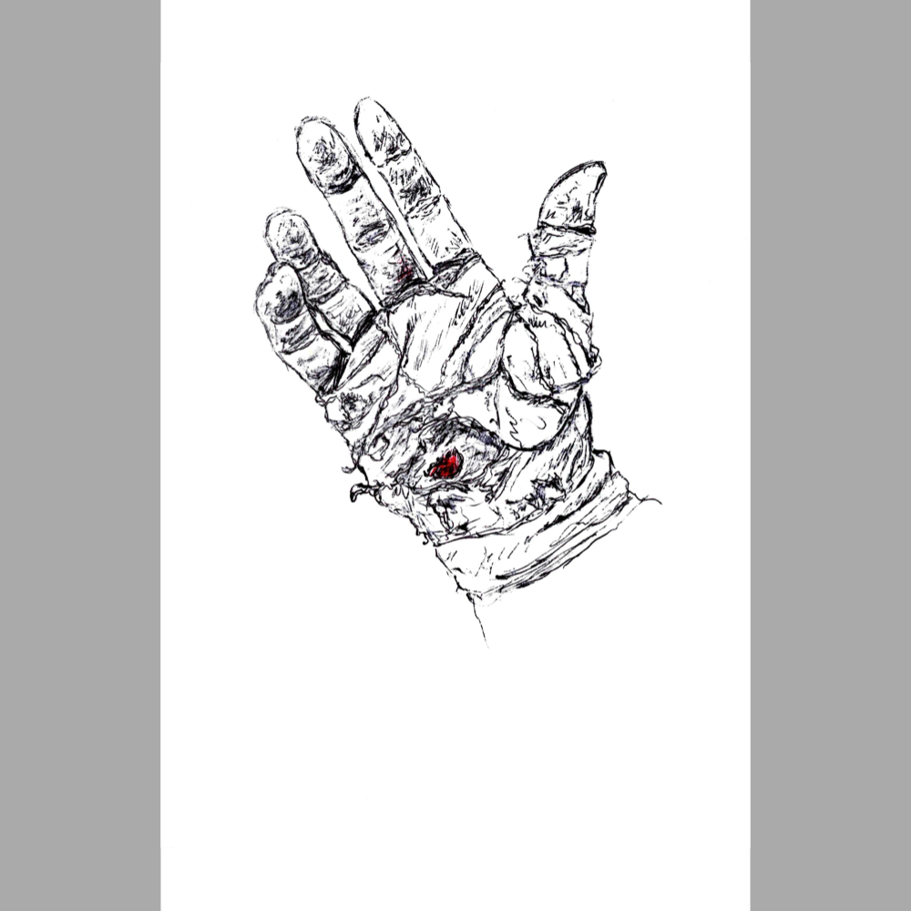 Palm Pain - Paper Print