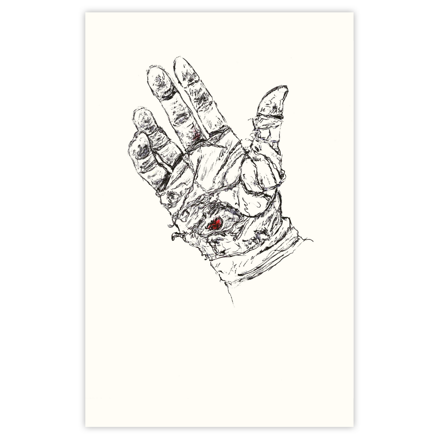 Palm Pain - Paper Print