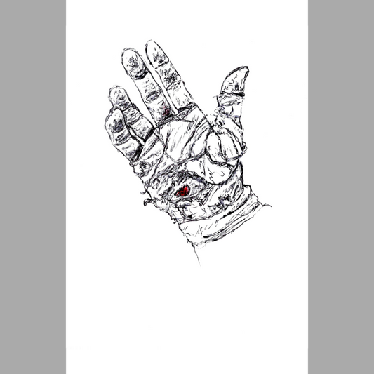 Palm Pain - Paper Print