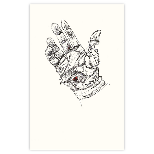Palm Pain - Paper Print